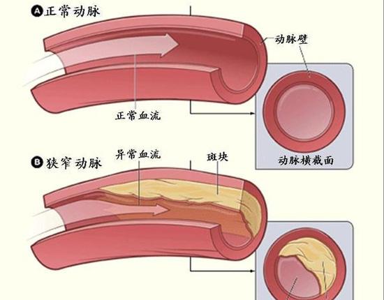 富硒荞子茶的功效(富硒荞子茶能降血脂吗)-硒宝网