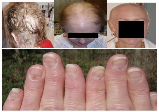 富硒食品真的有这么神奇么（富硒食品真的有用吗）-硒宝网