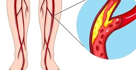 硒的作用和补硒的好处（缺硒有什么症状）-硒宝网