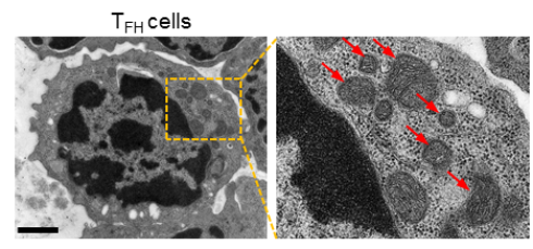 免疫力低补硒有用吗（吃硒酵母可以提高免疫力吗）-硒宝网