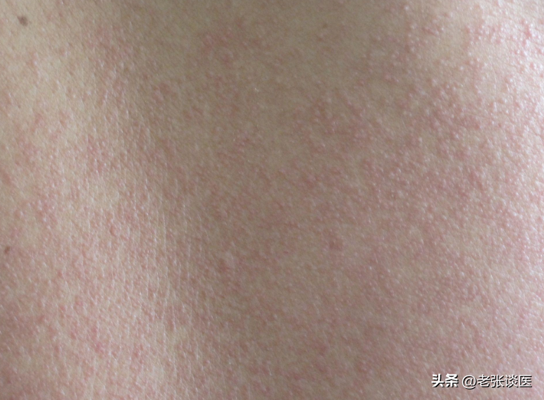 硒到底是致癌还是抗癌(硒对人体有什么好处)-硒宝网