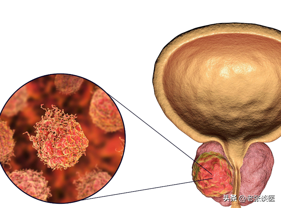 硒到底是致癌还是抗癌(硒对人体有什么好处)-硒宝网