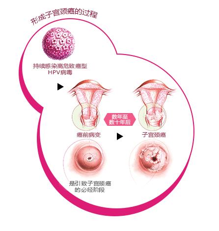 hpv每天补充多少硒(每天补充硒元素有什么不好)-硒宝网