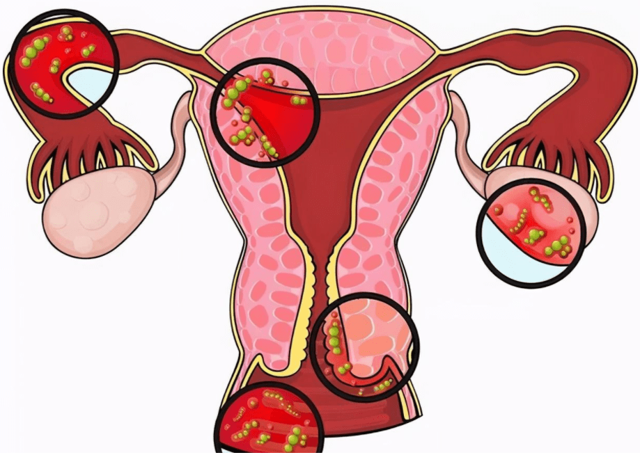 补硒对妇科病有效果吗（效果妇科病补硒有什么作用）-硒宝网