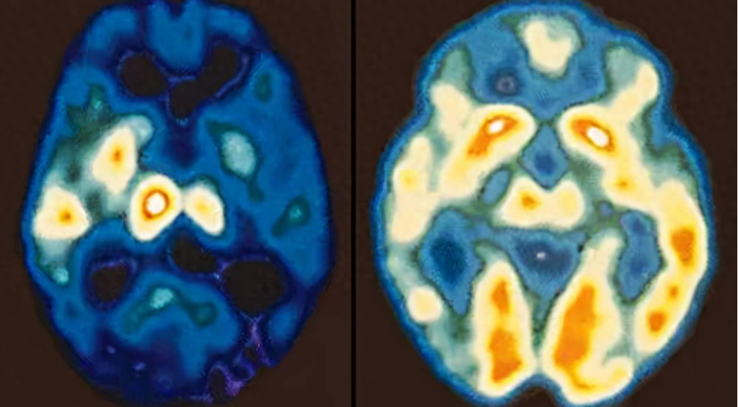硒的副作用和补硒的好处(补硒一般要连续补多久)-硒宝网