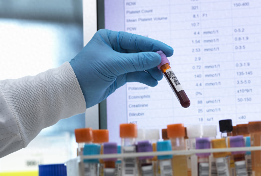 硒的副作用和补硒的好处(补硒一般要连续补多久)-硒宝网