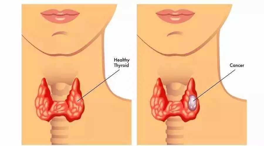 人体补硒有什么作用(补充硒的作用)-硒宝网