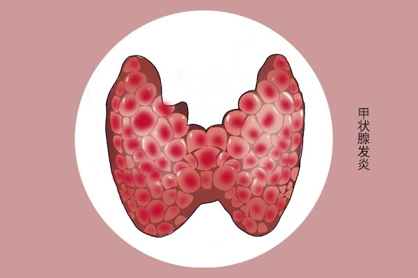补硒要补什么样的硒（硒质控样浓度）-硒宝网