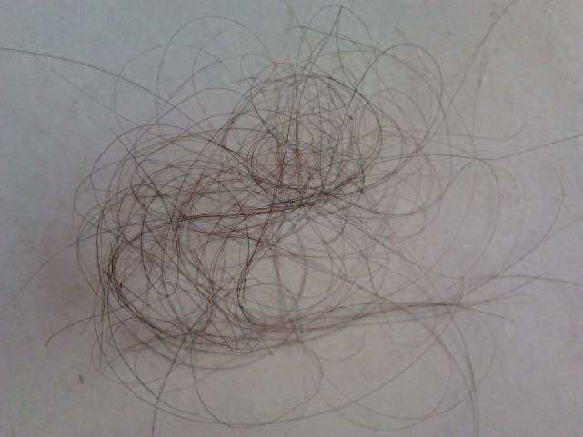 成人每天补多少硒(每天成人补硒多少)-硒宝网