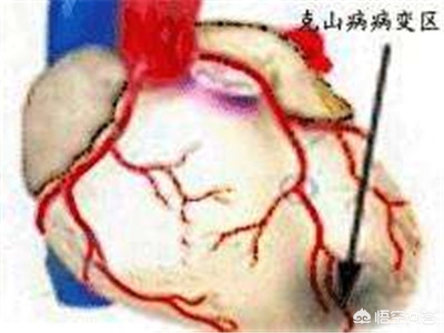 科学补硒选择补充什么硒(科学补硒与硒科普)-硒宝网