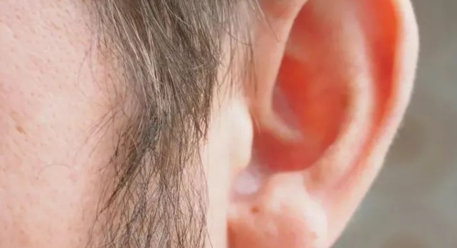 血脂高可以补硒吗（吃什么水果可以补硒）-硒宝网