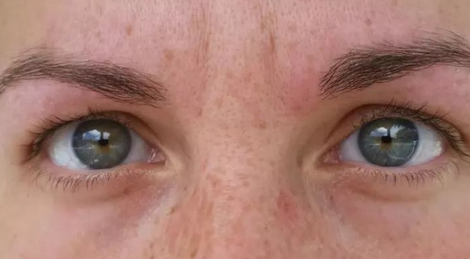 血脂高可以补硒吗（吃什么水果可以补硒）-硒宝网