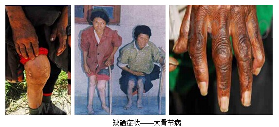 怎么科学补硒（科学补硒有哪十大好处）-硒宝网