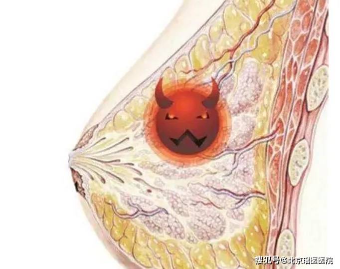 甲状腺结节可以补硒吗（补甲状腺结节硒可以吗）-硒宝网