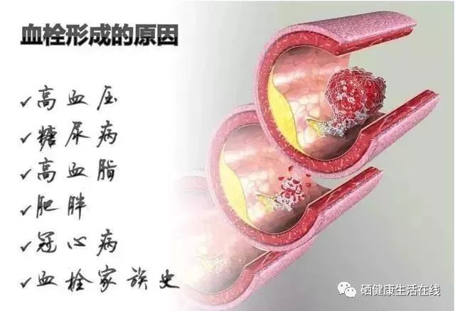 补硒后身体有调节反应（补硒调整反应）-硒宝网
