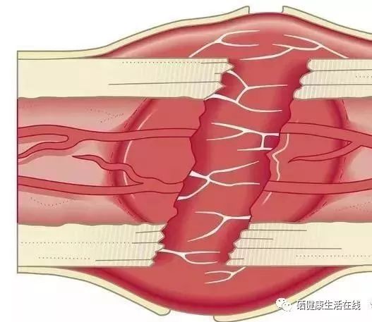 补硒后身体有调节反应（补硒调整反应）-硒宝网