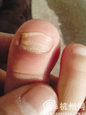 补硒是空腹还是饭后好(硒饭前吃饭后吃)-硒宝网