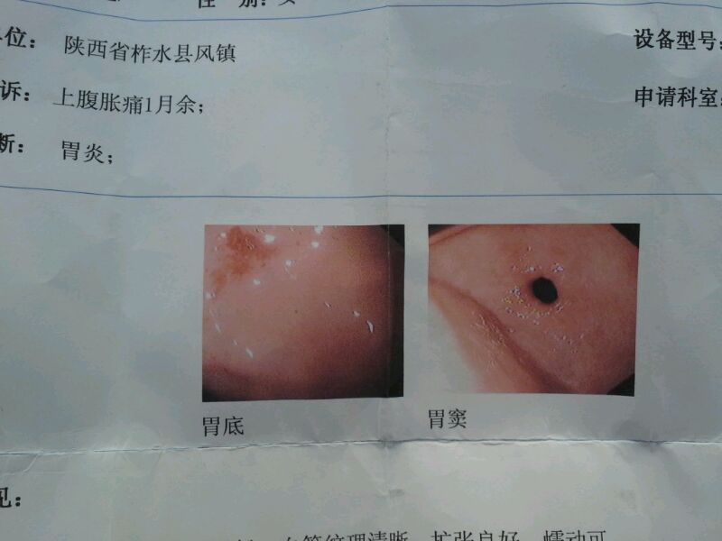 慢性胃炎可以补硒吗吗(慢性补胃炎硒可以长期吃吗)-硒宝网