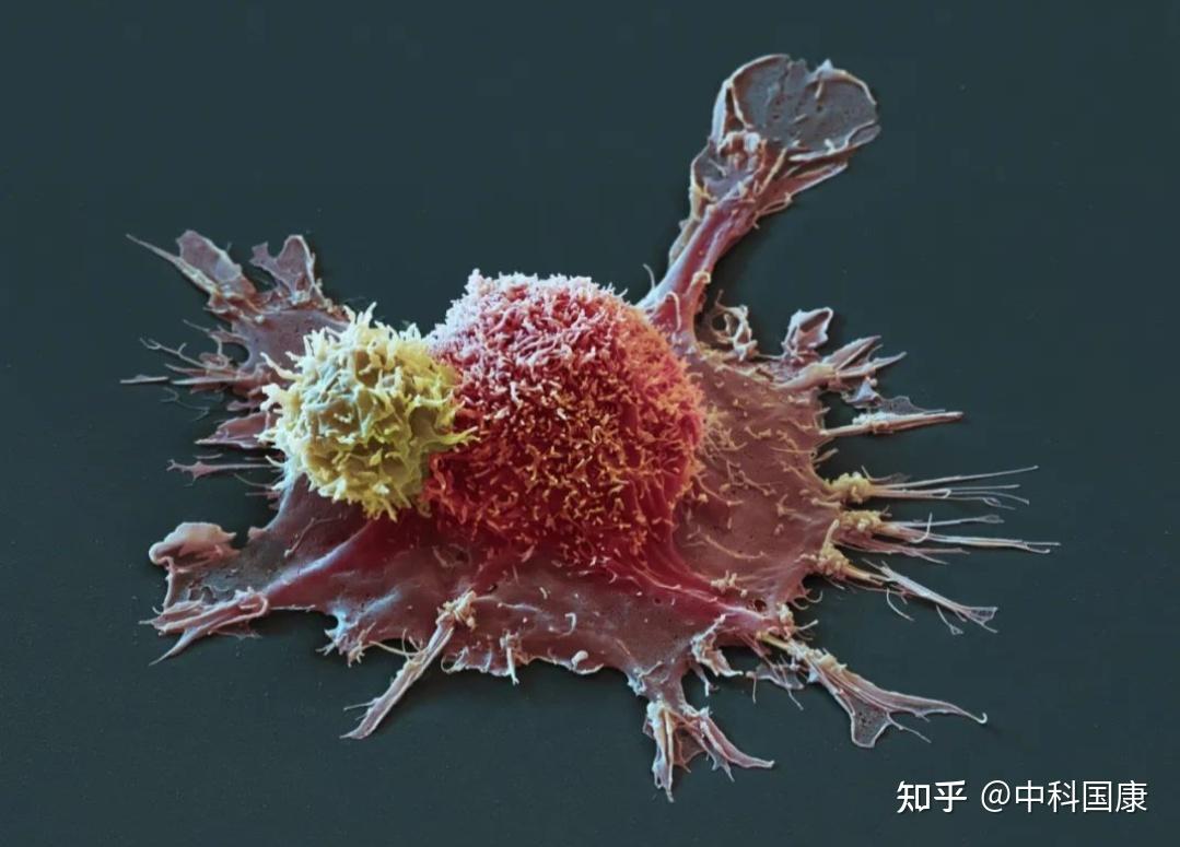 原位癌病人需要补硒吗(癌症补硒)-硒宝网