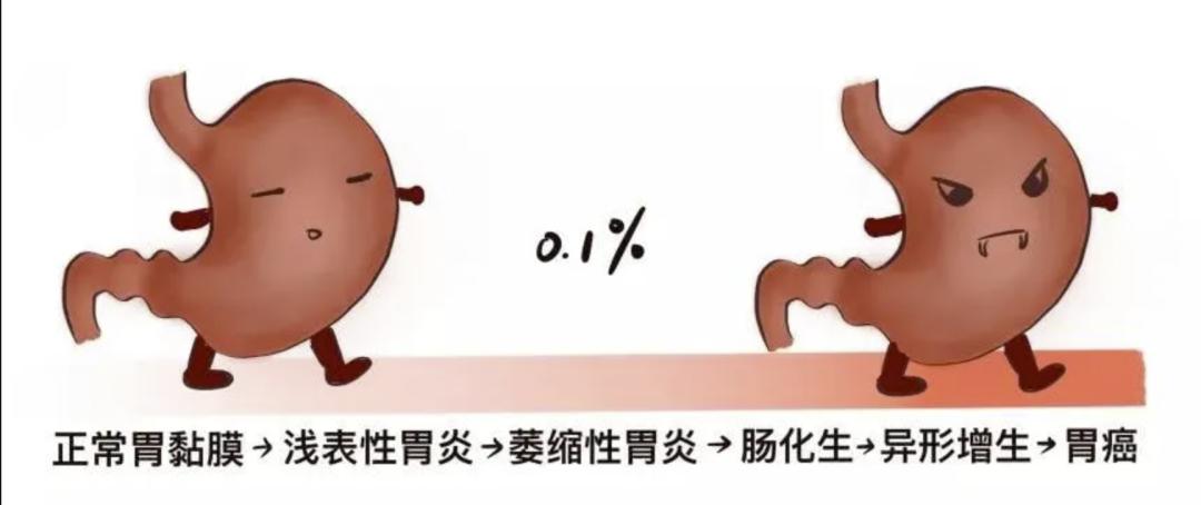 慢性胃炎可以补硒吗吗(慢性胃炎可以补硒吗)-硒宝网