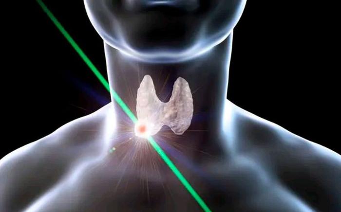 有甲状腺结节纯补硒吗(甲状腺结节补硒有什么好处)-硒宝网