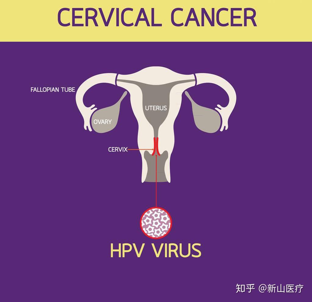 宫颈电切术后能补硒吗(电术能切补宫颈硒元素吗)-硒宝网