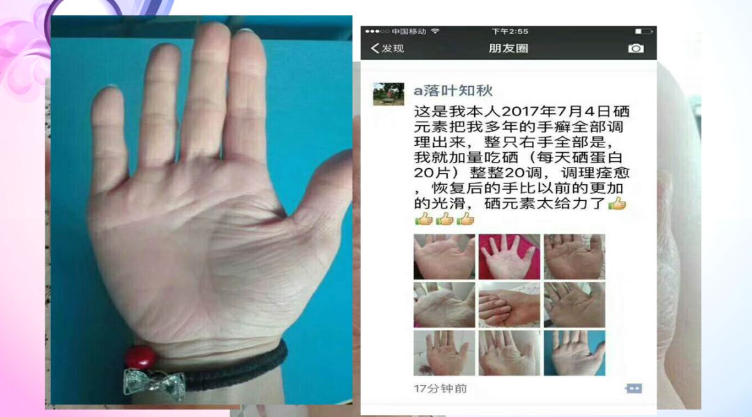 肝病患者补硒治愈视频(各个电视台补硒视频)-硒宝网