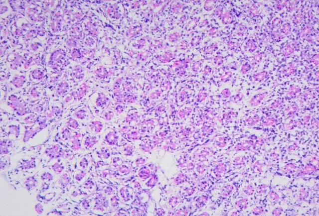 刚开始补硒为什么会饿(补硒会增加食欲吗)-硒宝网