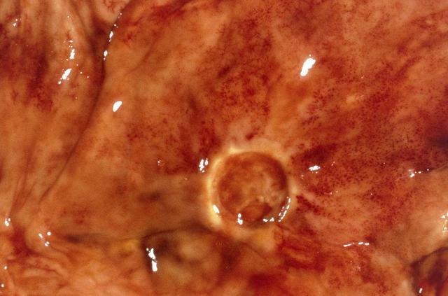 刚开始补硒为什么会饿(补硒会增加食欲吗)-硒宝网