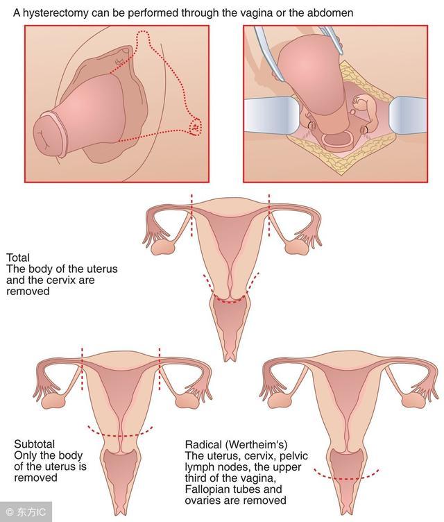 宫颈电切术后能补硒吗(宫颈病变可以补硒吗)-硒宝网