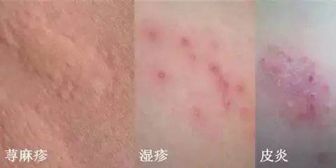补硒后全身痒怎么回事(补硒后为什么失眠)-硒宝网