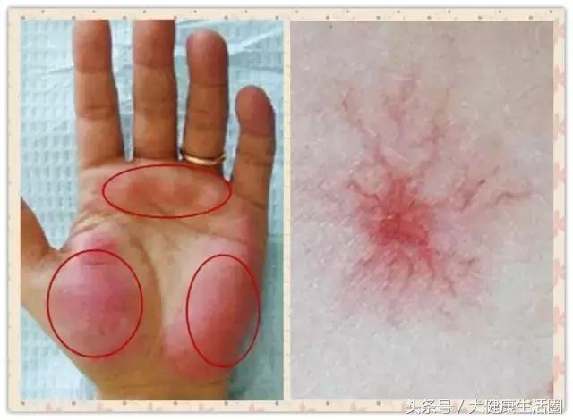 补硒可以降低雌激素吗(硒可以调节女性激素吗)-硒宝网