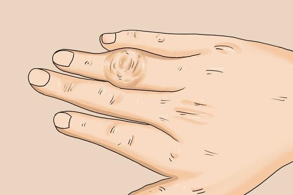 病人一天补多少毫克硒(病人补一天硒多少克)-硒宝网