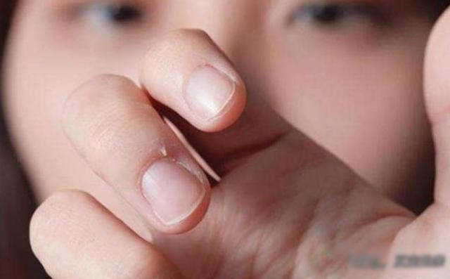 孩子一天补多少硒安全(孩子补硒有什么好处)-硒宝网