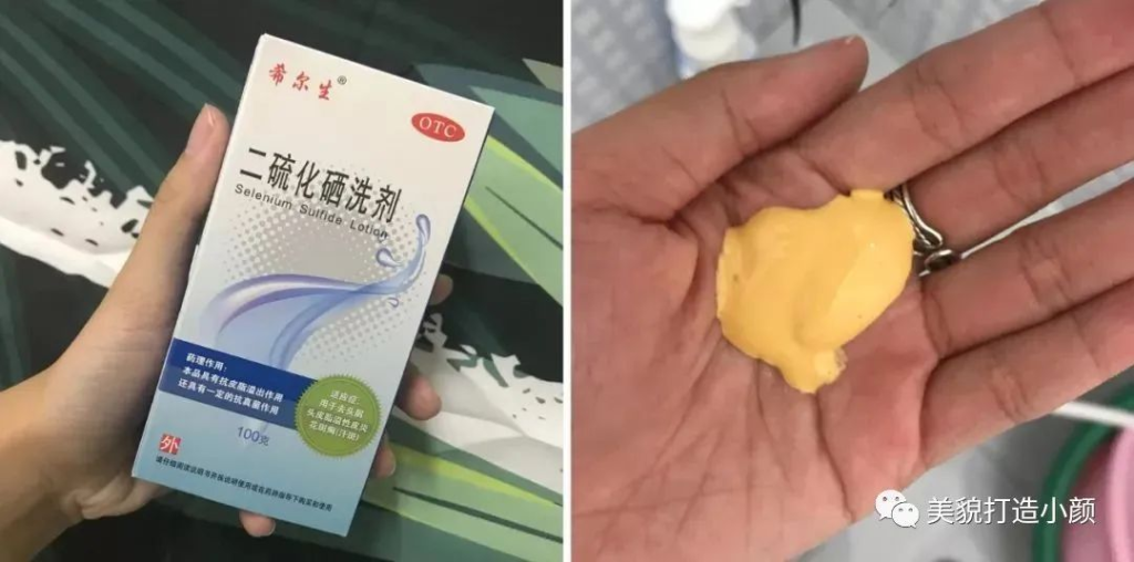 二硫化硒洗剂的作用(能治疗毛囊炎引起的脱发吗)-硒宝网