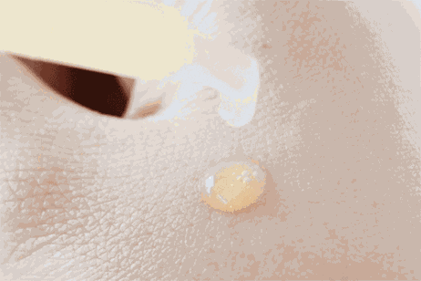 二硫化硒洗剂会导致脱发吗（和洗发水混用有副作用吗）-硒宝网