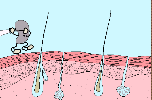 二硫化硒洗头的危害(二硫化硒的功效与禁忌)-硒宝网