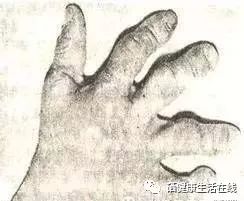 缺硒症状成人怎么补硒(硒成人缺症状补什么好)-硒宝网