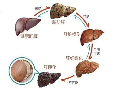 脂肪肝能否补硒元素硒(硒肝脂肪能否补元素A)-硒宝网