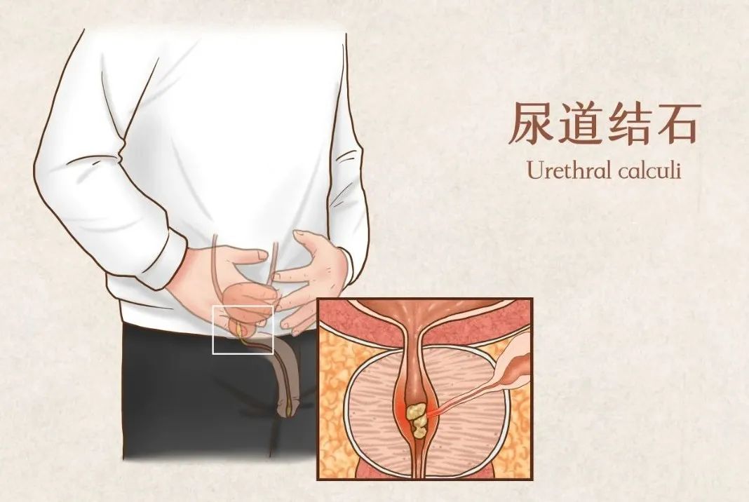 补硒补多少适量盐水好（如何补硒d.吃高吉星蛋白硒好）-硒宝网