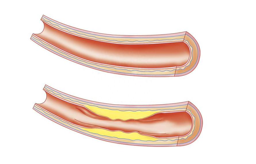 过量补硒会有什么害处(过量补硒对身体有哪些损害)-硒宝网