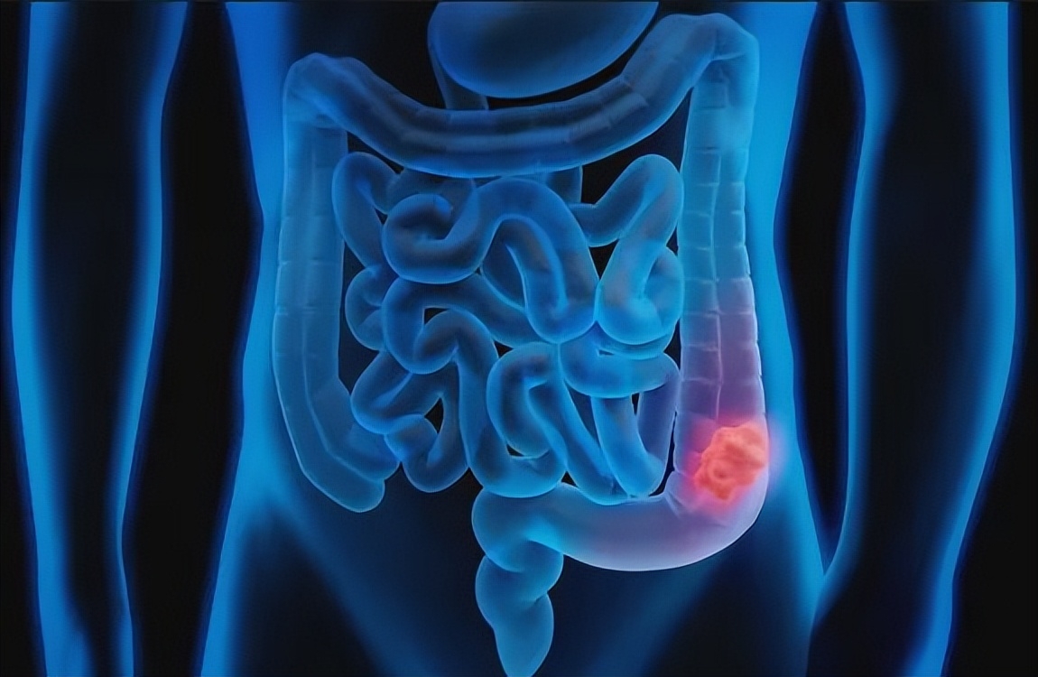 过量补硒会有什么害处(过量补硒对身体有哪些损害)-硒宝网