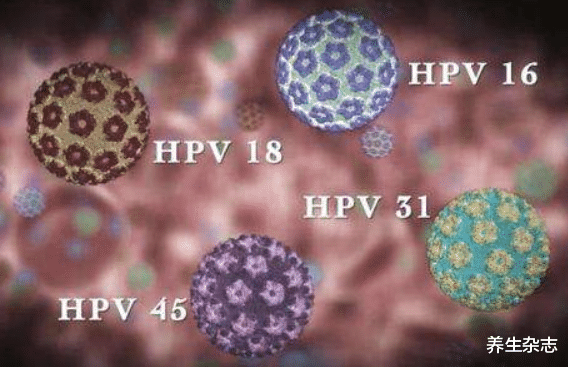 感染hpv补硒吃什么(hpv患者吃硒能改善吗)-硒宝网