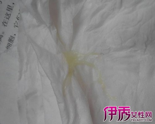 白带异常腰疼可以补硒(硒片对妇科炎症有效果吗)-硒宝网