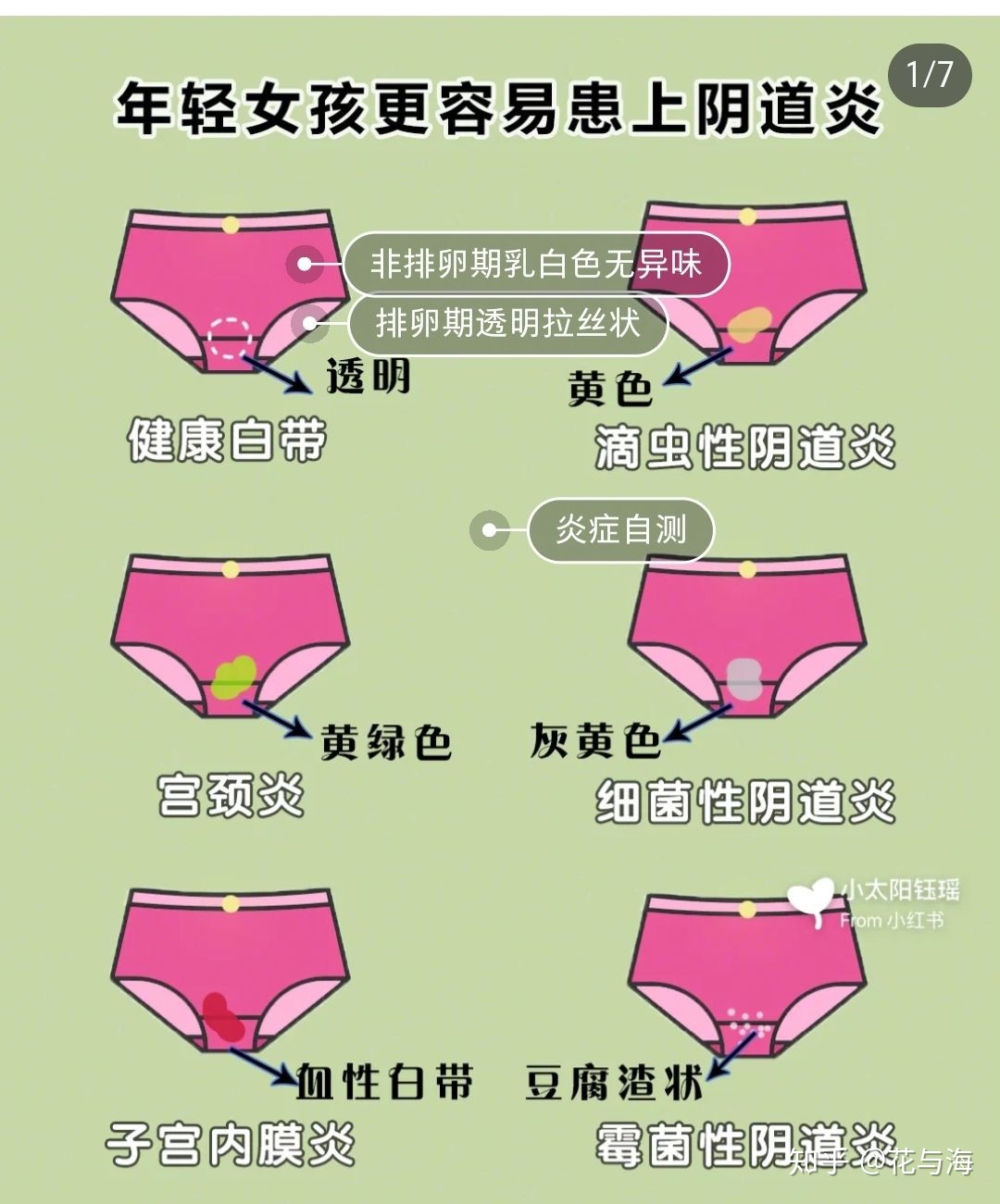 白带异常腰疼可以补硒(硒片对妇科炎症有效果吗)-硒宝网