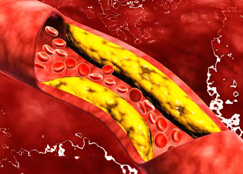 补硒多了会有什么反应（补硒的调理反应）-硒宝网