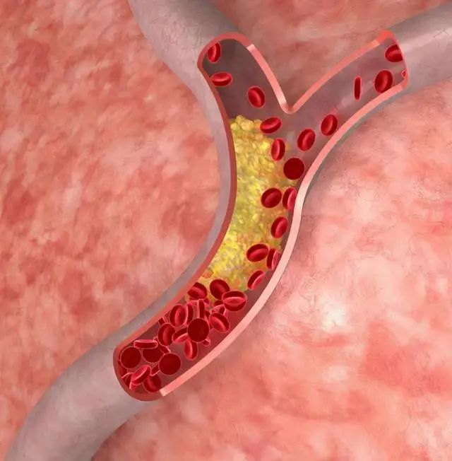 补硒多了会有什么反应（补硒的调理反应）-硒宝网