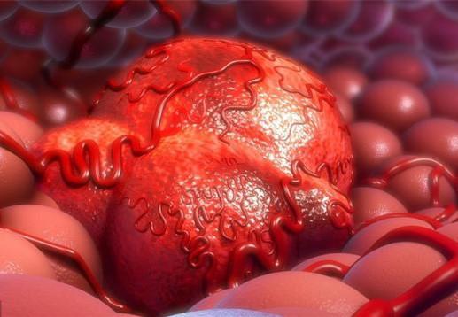 hpv阳性为啥要补硒（hpv阳性补充硒会有效果吗）-硒宝网