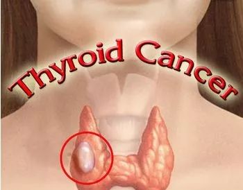 甲状腺补哪个牌子的硒（甲状腺补硒的药）-硒宝网