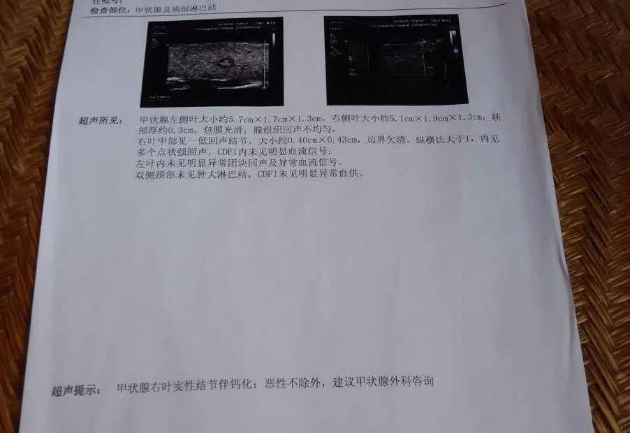 甲状腺切除可以补硒吗(甲状腺术后补硒)-硒宝网